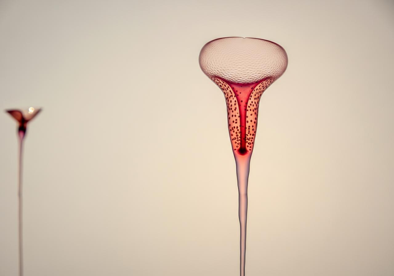 Blood in Urine with No Pain: Causes and Solutions